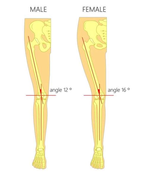 What Is Patellofemoral Pain Syndrome And How Do I Treat It