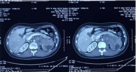 CT scan with contrast. | Download Scientific Diagram