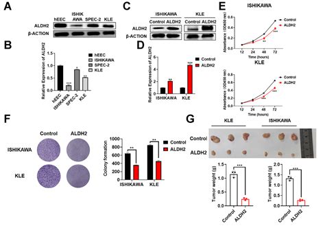 Aldh2 Promotes Uterine Corpus Endometrial Carcinoma Proliferation And