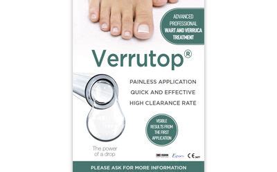 Verrutop Verruca Treatment Sandy Bielby Podiatry And Chiropody