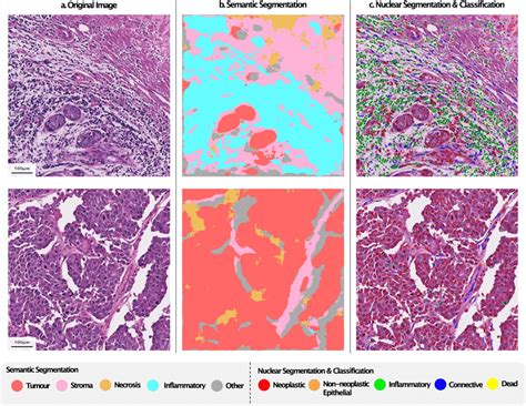 Illustration Of Simultaneous Tissue Segmentation Nucleus Download Scientific Diagram