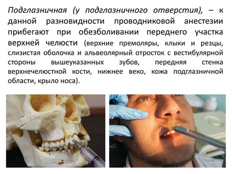 Аппликационная анестезия в стоматологии презентация