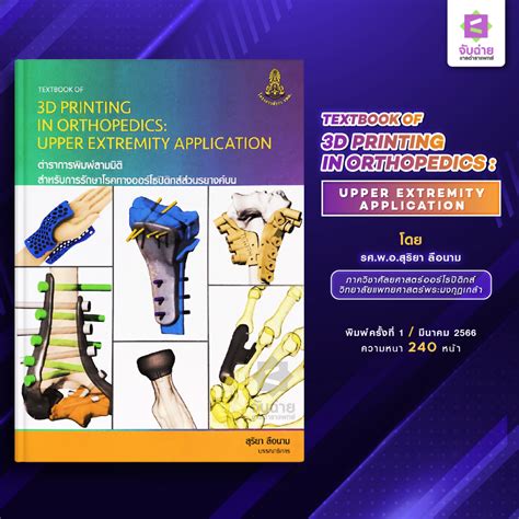 Textbook Of 3d Printing In Orthopedics Upper Extremity Application Shopee Thailand