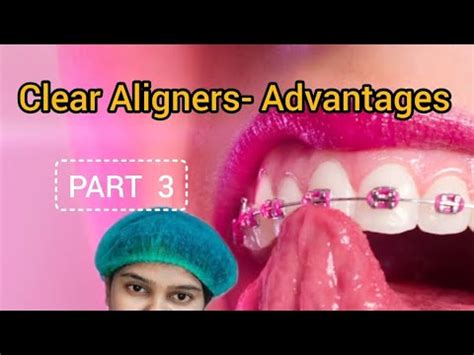 Clear Aligners Invisalign Advantages In Tamil Youtube