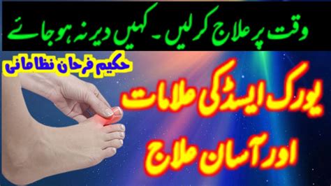 Uric Acid Ka Ilaj Uric Acid Treatment In Hindi Hakeem Farhan Nizamani Youtube