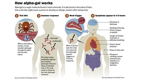 Alpha Gal Syndrome The Link Between Ticks And Red Meat Allergy