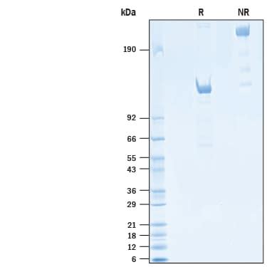 Recombinant Human Siglec 2 CD22 Fc Chimera Protein CF 1968 SL 050 R D