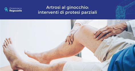 Artrosi Al Ginocchio Interventi Di Protesi Parziali Dr Gianmarco