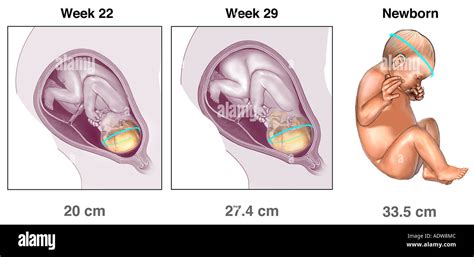 Cr Neo Del Feto Fotograf As E Im Genes De Alta Resoluci N Alamy