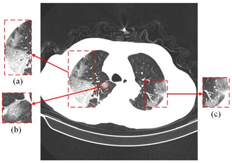 Diagnostics Free Full Text Deep Learning Based Covid Diagnosis