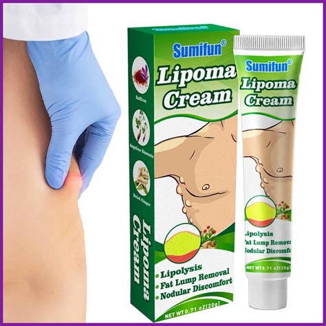 Lipoma Removal Cream Herbal Lipoma Lumps Elimination Ointment Safe To