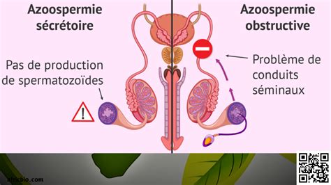 Azoospermie Symptômes Traitement Naturel par les Plantes