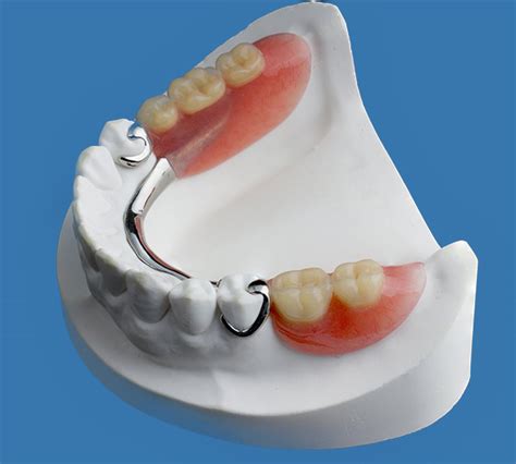 Dentures - Dr Ken Lipworth
