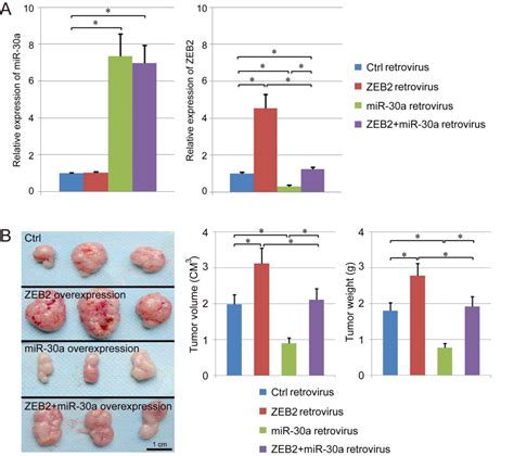 Microrna‑30a Regulates Cell Proliferation Migration Invasion And