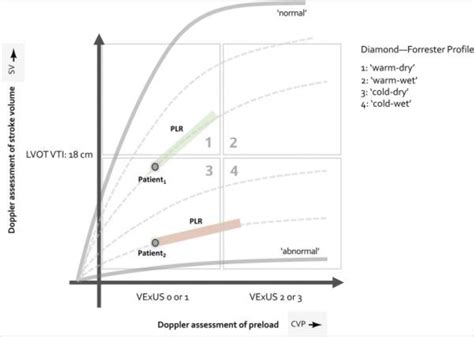 Unifying Fluid Responsiveness And Tolerance Flosonics Medical