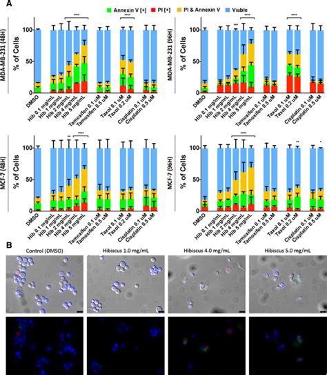 Hibiscus Flower Extract Selectively Induces Apoptosis In Breast Cancer