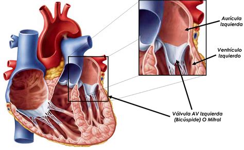 DOCTORCITO ESTENOSIS MITRAL