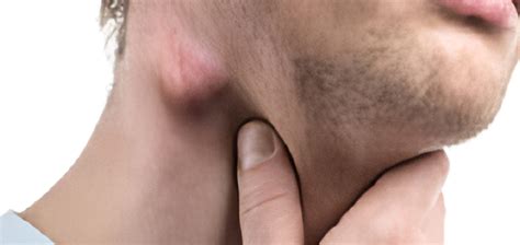 लमफ नडस म सजन Swelling in lymph nodes तन स चर सपतह तक