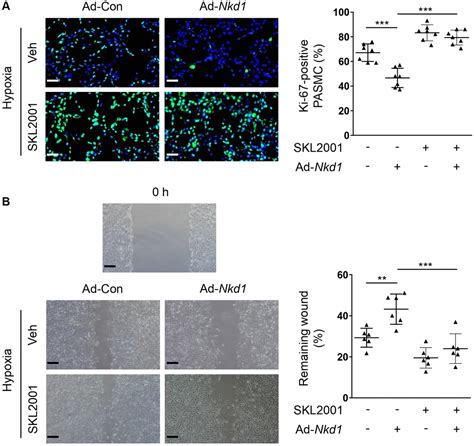 Naked Cuticle Homolog 1 Prevents Mouse Pulmonary Arterial Hypertension