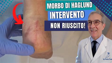 Morbo Di Haglund Intervento Non Riuscito Cosa Fare Haglund Prima E