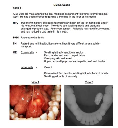 Case 1 OMED Swellings Flashcards Quizlet