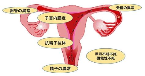 産婦人科「体外受精」 ｜丸山記念総合病院