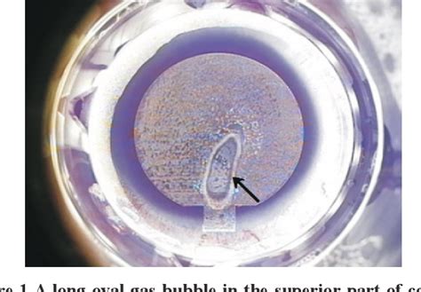 Pdf Managements Of Vertical Gas Breakthrough In Femtosecond Laser