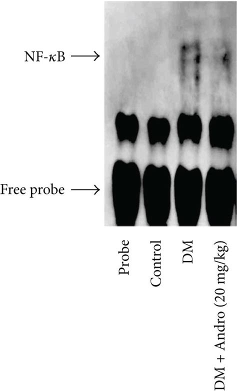 Andro Treatment Suppresses Nf κb Activation In The Diabetic Myocardium