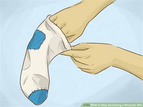 3 Ways To Stop Scratching A Mosquito Bite WikiHow Health