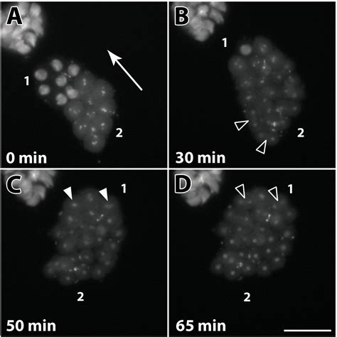 Ex Vivo Culture Of Drosophila Pupal Testis And Single Male Germ Line