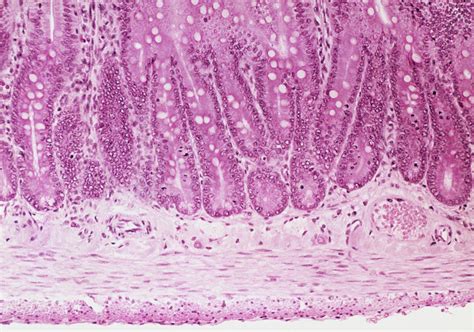 Lm Of A Section Through The Small Intestine Wall By Science Pictures