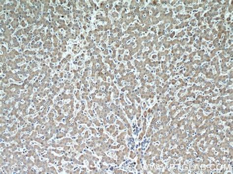 Cytoglobin Mouse Anti Human Mouse Porcine Rat Clone 4c7e11