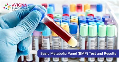 Basic Metabolic Panel Bmp Test And Results