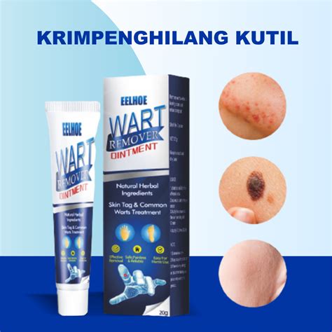 Jual Krim Penghilang Tahi Lalat Di Wajah Permanen Sumifun Wart Remover