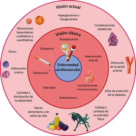 Riesgo Cardiovascular En Personas Con Diabetes Tipo 1 Revista Diabetes