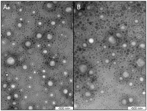 Micrographs Of The Chitosan Nanoparticles Obtained Soon After