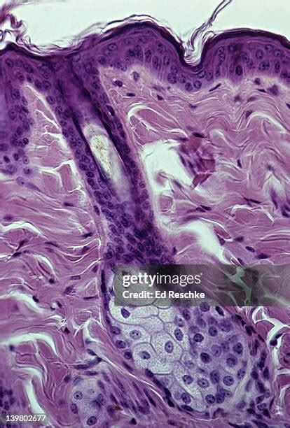 321 Sebaceous Glands Stock Photos High Res Pictures And Images