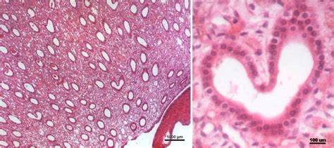 Médula Renal Conducto Colector Histología Y Embriología