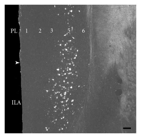 Dark Field Photomicrographs Showing A The Distribution Of