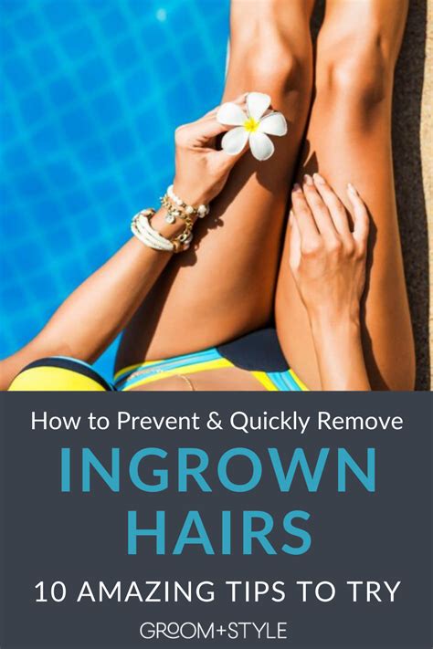 How To Remove And Prevent Ingrown Hairs Fast In 2021 Ingrown Hair