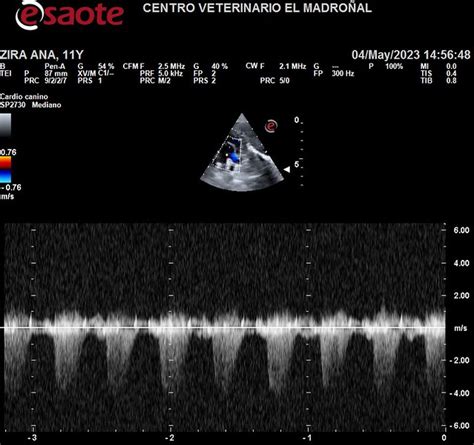 Zira Estenosis Aortica E Insuficiencia Tricuspide Centro Veterinario