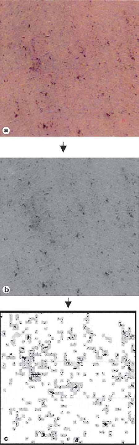 figure     role  vernix caseosa   skin cleanser