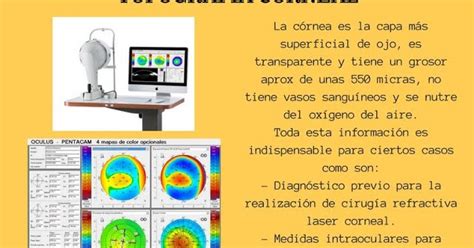 Clínica de Ojos Oftalmic Láser TOPOGRAFIA CORNEAL