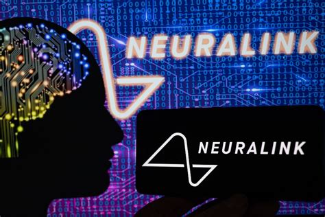 Impiantato Su Un Essere Umano Il Primo Chip Cerebrale Di Neuralink Ma