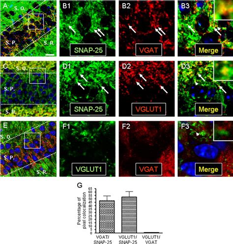 Expression And Function Of SNAP 25 As A Universal SNARE Component In