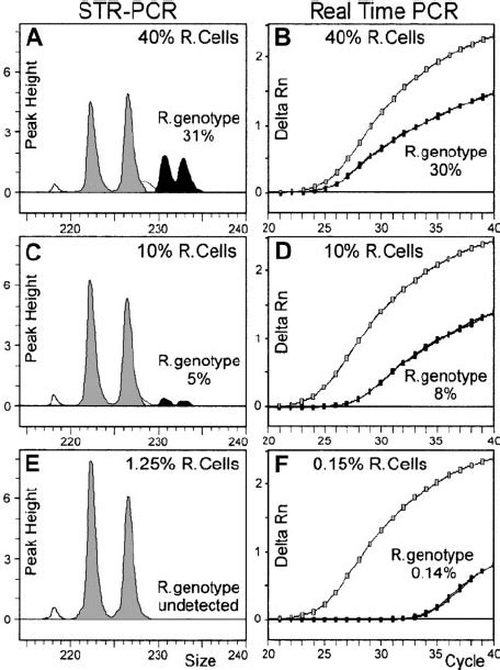 Comparison Of Str Pcr And Real Time Pcr Chimerism Assays Dna Extracted