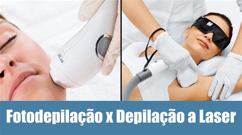 Fotodepilação x Depilação à laser Qual é a melhor opção YouTube