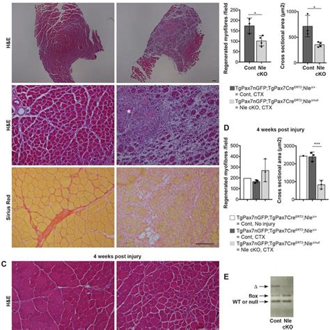 Conditional Ablation Of Nle During Adult Muscle Regeneration Results In