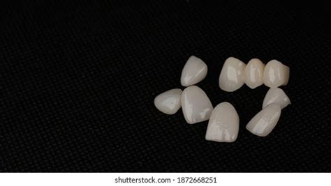 407 Dental Laminates Images, Stock Photos & Vectors | Shutterstock