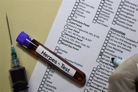 Herpes Test With Blood Sample Top View Isolated On Office Desk Stock